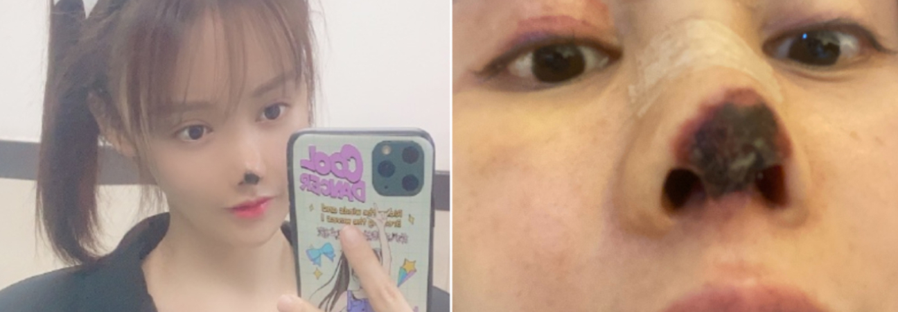 Chirurgie esthétique chine