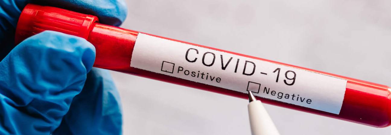 covid 19 variant