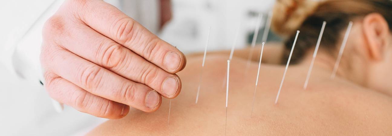 acupuncteur