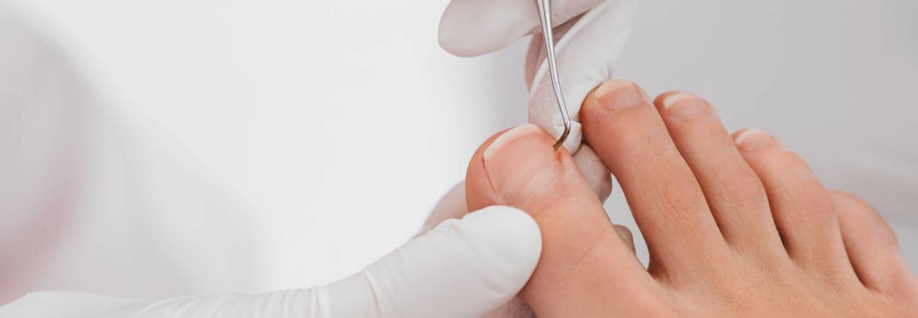 pedicure podologue