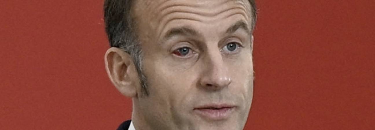 macron oeil